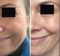 Repachage Vita Cura B3 Serum Complex